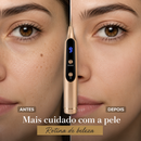 Caneta Removedora de Manchas – Mais Cuidado com Sua Pele